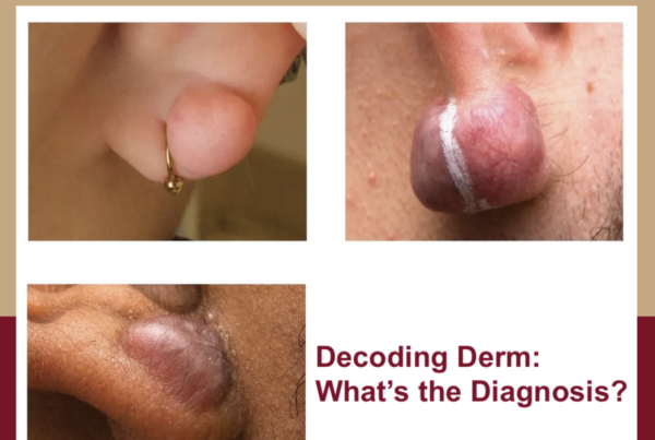Journal of Drugs in Dermatology JDD About The Full Spectrum of Dermatology: A Diverse and Inclusive Atlas. The images is of keloid among different skin tones
